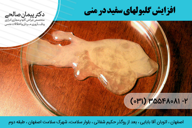 درمان پیواسپرمی در اصفهان