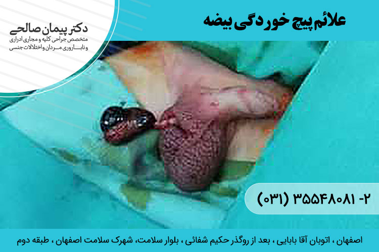 درمان پیچ خوردگی بیضه در اصفهان